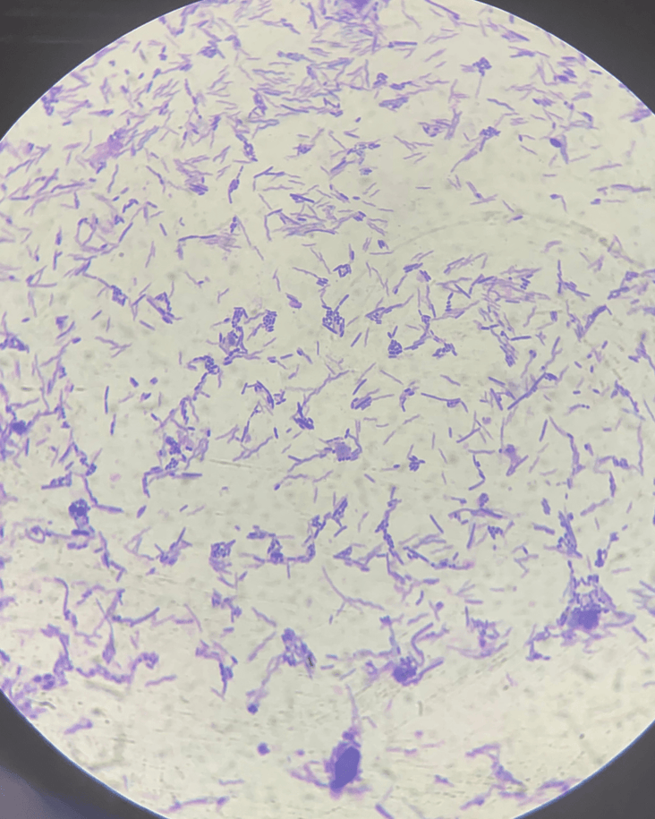 後生元、益生菌、益生元該怎麼選？還是其實需要一起？