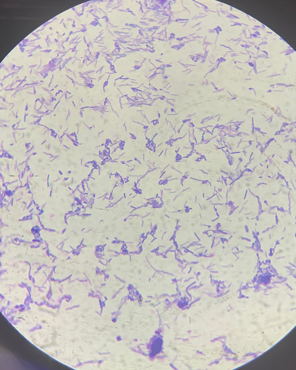 後生元 益生菌 益生元